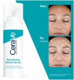 CeraVe Anti-Onzuiverheden Retinol Serum - tegen Vlekjes en Restlittekens - voor een Onzuivere Huid met Neiging tot Acne - 30ml - Image 4