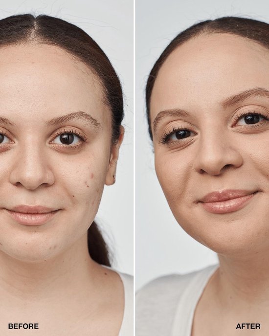 550x687-213 Clinique Foundation Even Better Clinical Serum Foundation SPF20 CN52 Neutral - Image 1