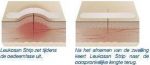 Leukosan Strip Ster 6x38mm (6 stuks) + 6x75mm (3 stuks) 72628-16 (9 stuks) - Image 2