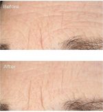 Perricone MD Essential Fx Acyl-Glutathione: Deep Crease Gezichtsserum 30 ml Vrouwen Roze - Image 4